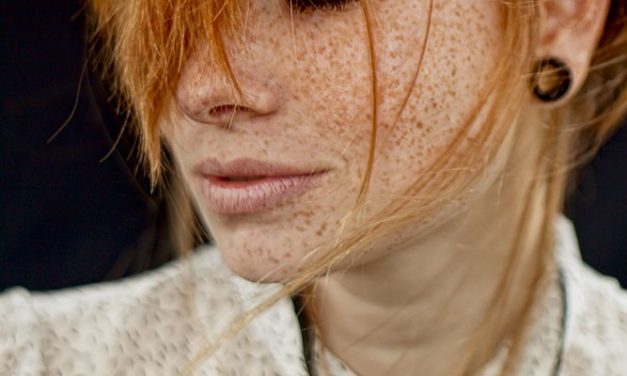 La photo du jour : freckles everywhere par Hady